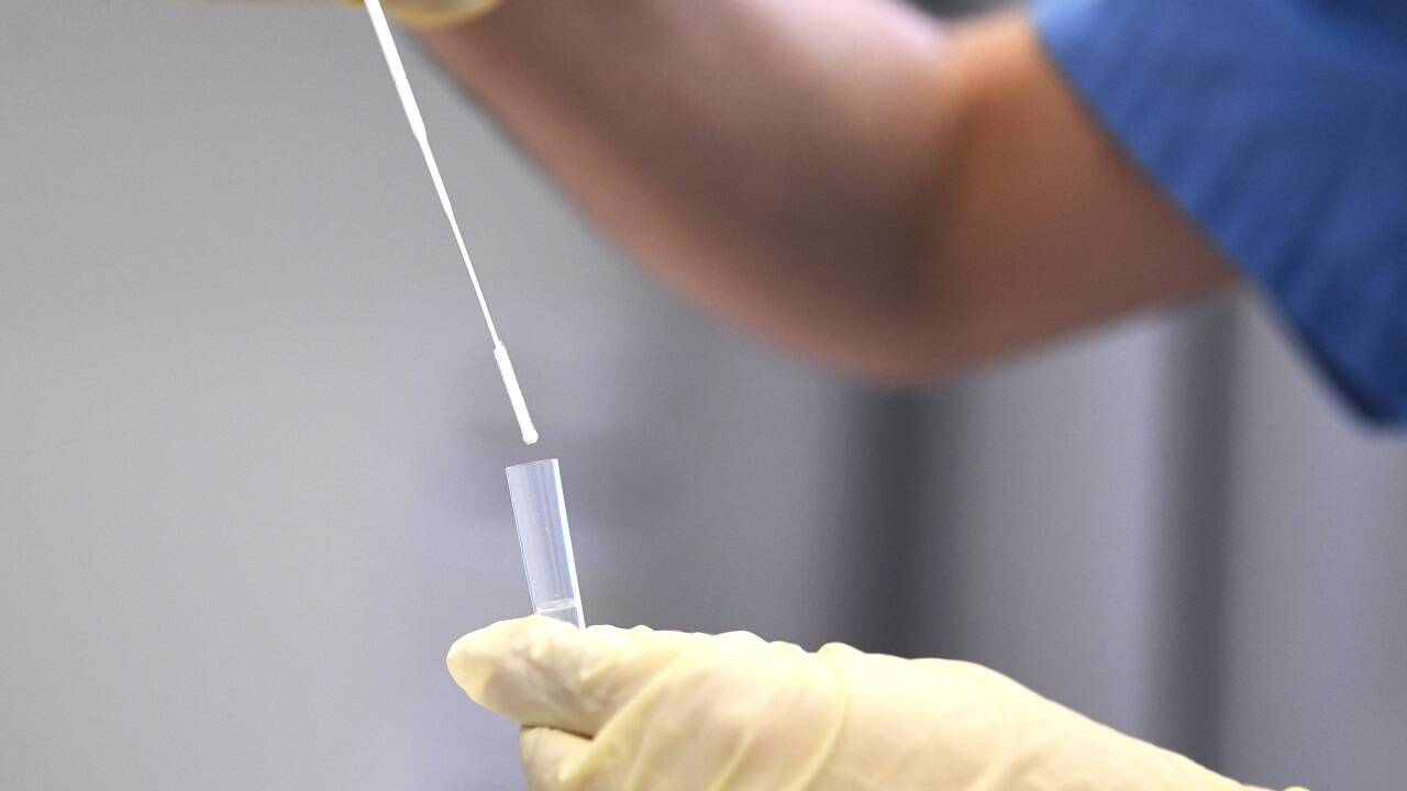 Selbst die PCR- und somit Labortests geben immer öfter Anlass zur Diskussion (Symbolbild). 