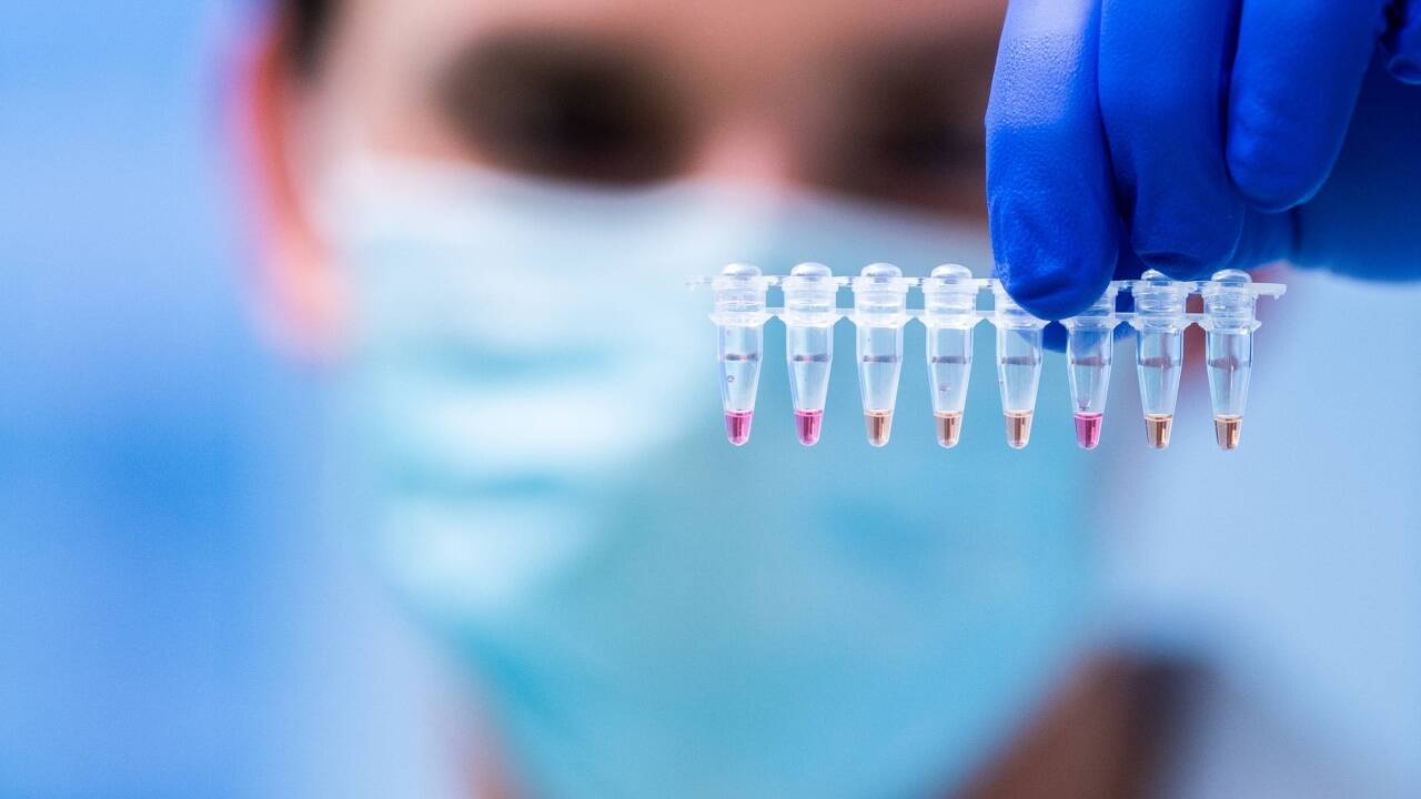 Flächendeckendes Testen sei eine gute Maßnahme, um gezielt Infizierte aus den Kontaktnetzwerken zu bekommen, sagt Forscher Niki Popper. 