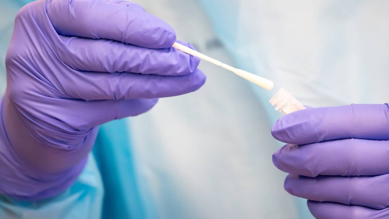 Bisher 2.000 Menschen für PCR-Test angemeldet 