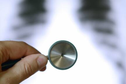 Mehr Frauen als Männer nutzen kostenloses Angebot 