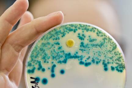 Resistente Bakterien können zum Problem werden. (Symbolbild) 