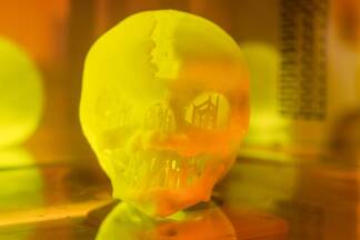 Beispiel aus dem 3D-Druck-Labor an den Salzburger Landeskliniken. 