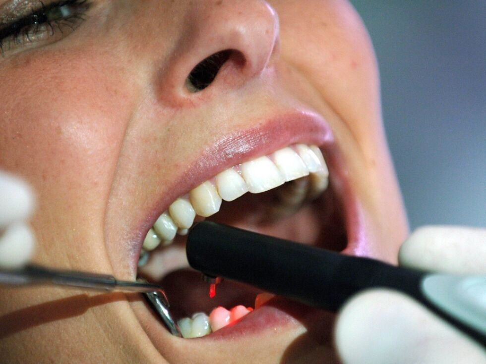 Test zobnih past za beljenje razkril pomanjkljivosti pri zaščiti pred kariesom