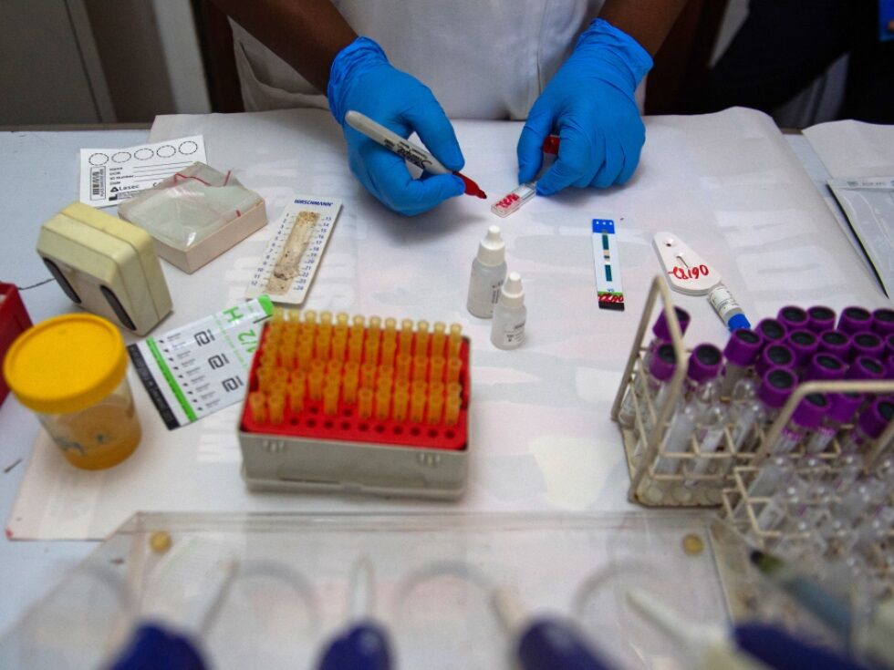 Nova metoda omogoča hitrejše testiranje virusnih vzorcev