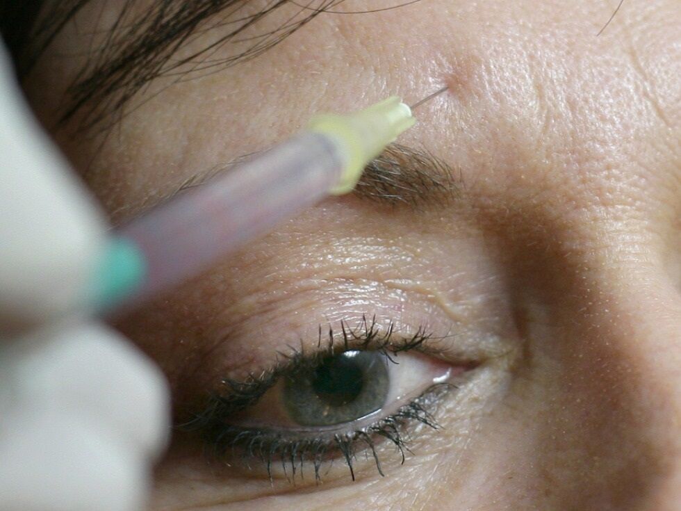 V Welsu sojenje Rusinji zaradi nestrokovnih lepotnih posegov