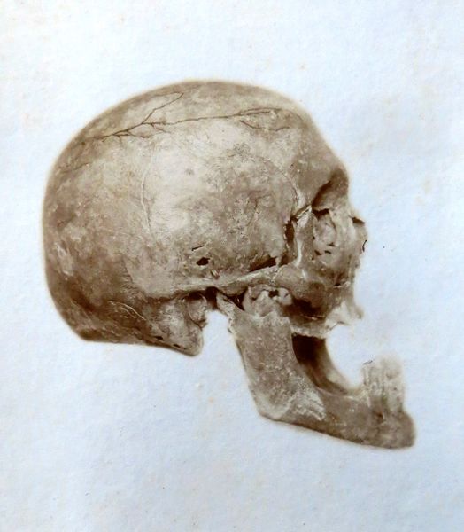 Datei:Mohr Joseph Schädel.jpg